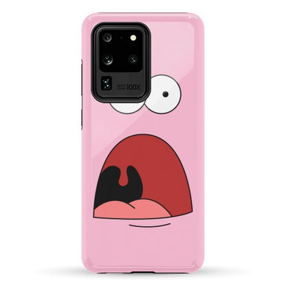 Patrick is Shocked Phone Case