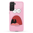 Patrick is Shocked Phone Case