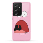 Patrick is Shocked Phone Case